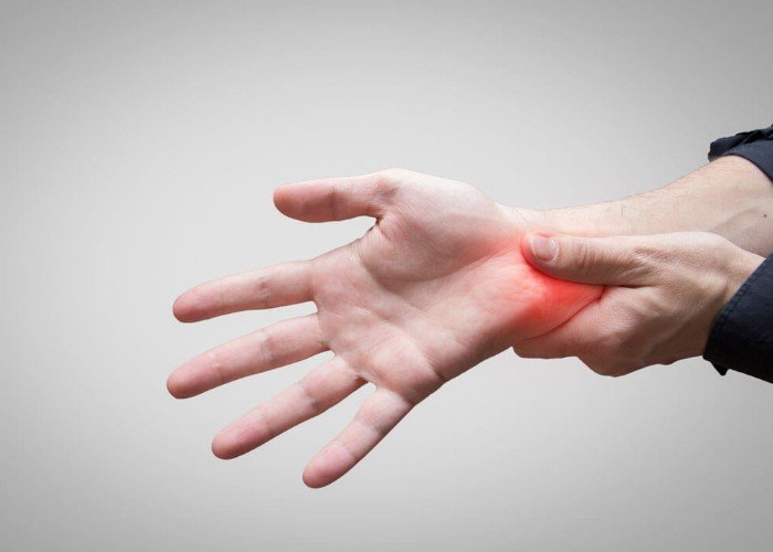 Cirurgia para Síndrome do Túnel do Carpo