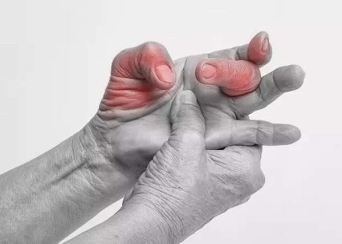 Tratamento do Dedo em Gatilho