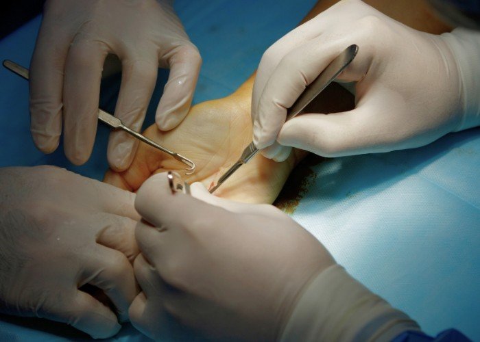 Microcirurgia Reconstrutiva